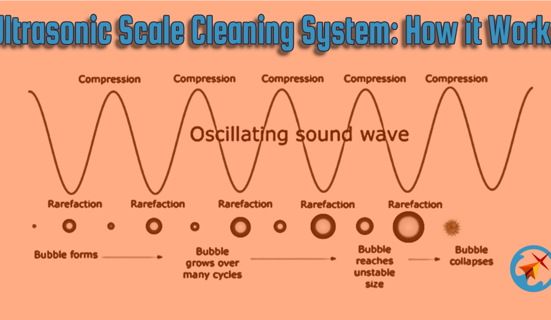 Ultrasonic Scale Cleaning System: How it works